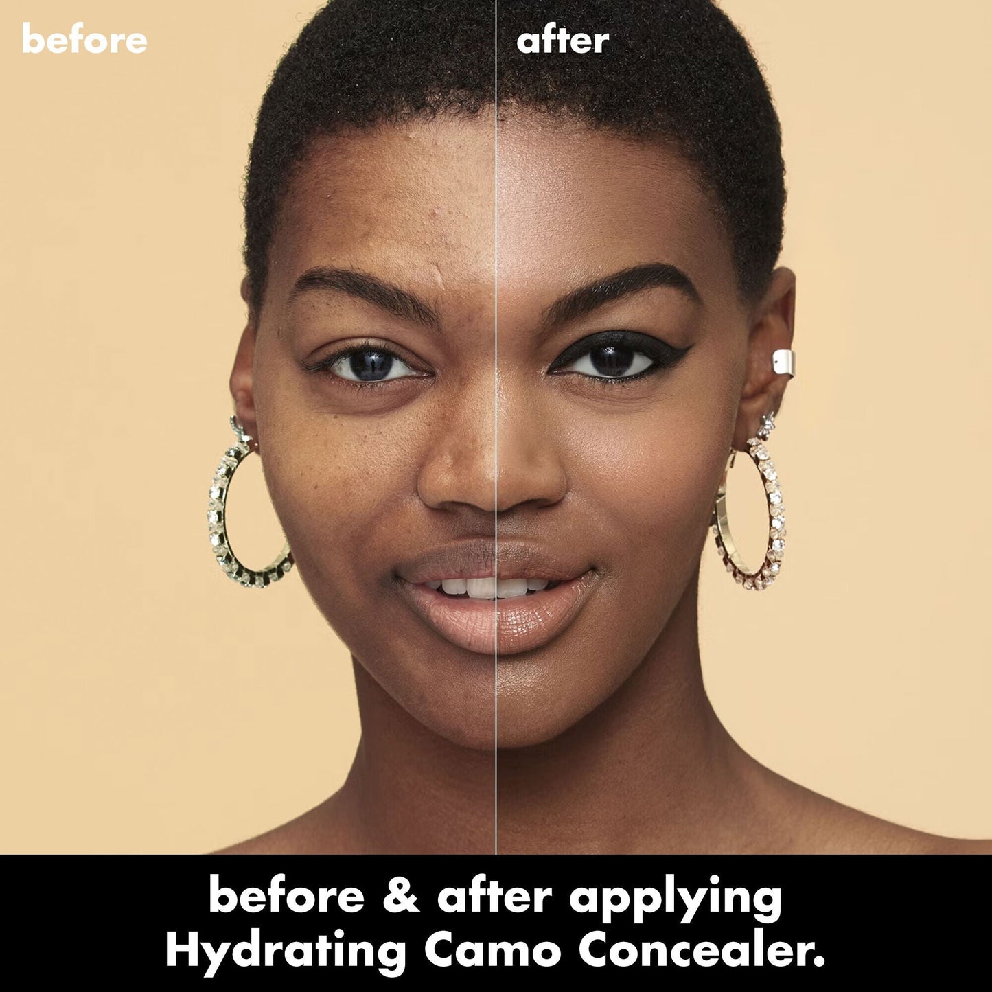 hydrating-camo-concealer-a7 0226_EDU_HydratingCamoConcelaer_BA_AshleyKaresh_20_1_d8499bbf-0e91-4173-b5e2-75127caf83a3.jpg