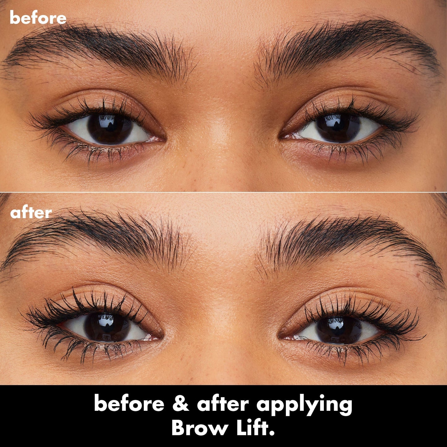 brow-lift-s3 0326_EDU_BrowLift_BA.jpg