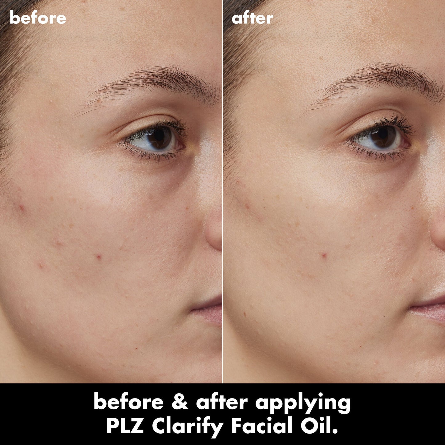 plz-clarify-facial-oil-z8 0326_EDU_PlzClarify_BA_Kelly.jpg