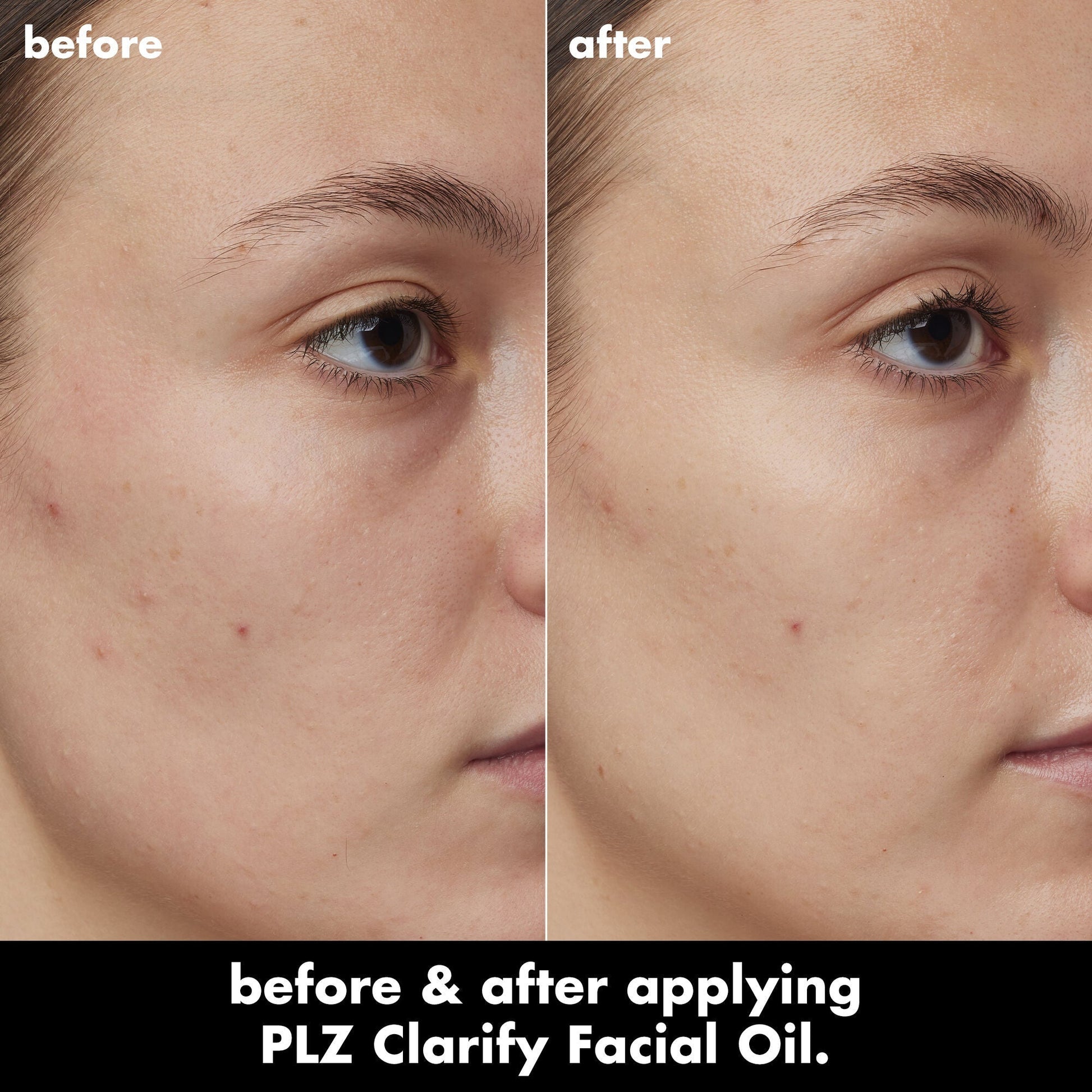 plz-clarify-facial-oil-z8 0326_EDU_PlzClarify_BA_Kelly.jpg
