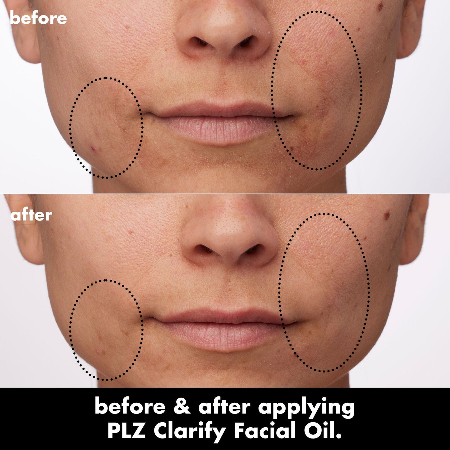 plz-clarify-facial-oil-z8 0326_EDU_PlzClarify_BA_Paula.jpg