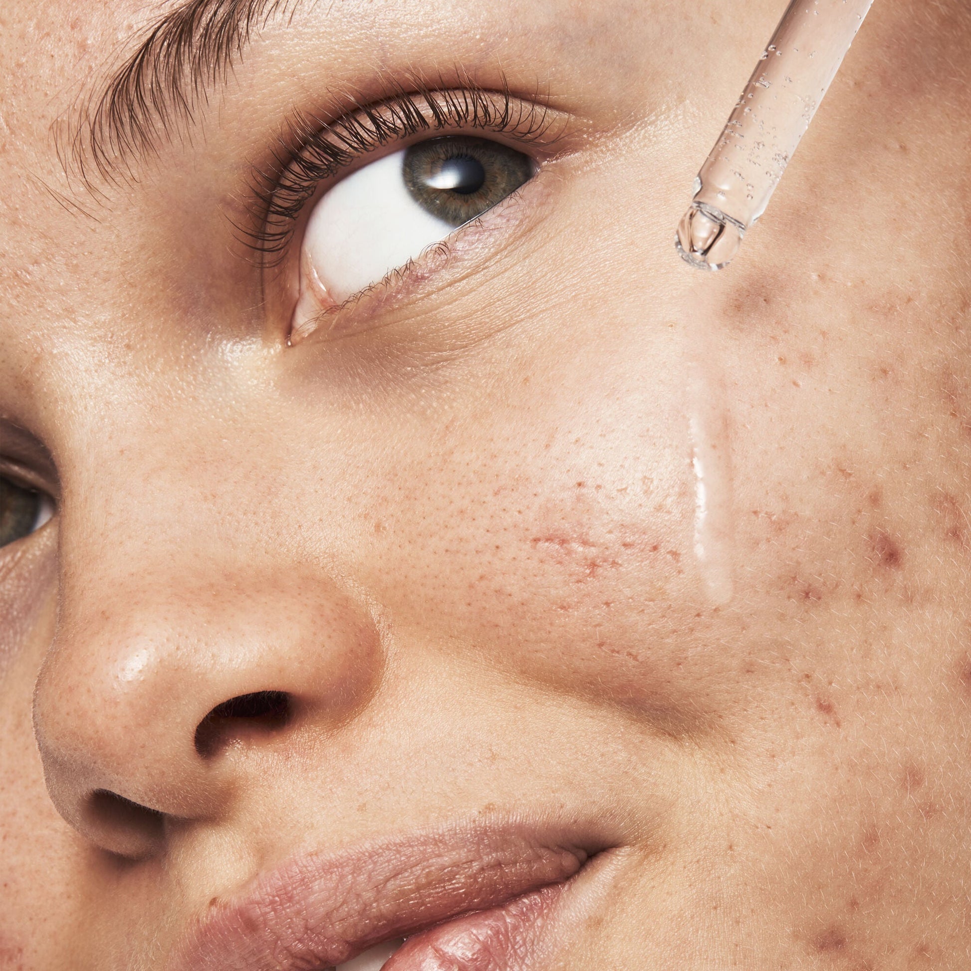 blemish-breakthrough-triple-acid-resurfacing-serum-n9 121321_Marley-Acne-Regimen_0254_FINAL_IGF.jpg