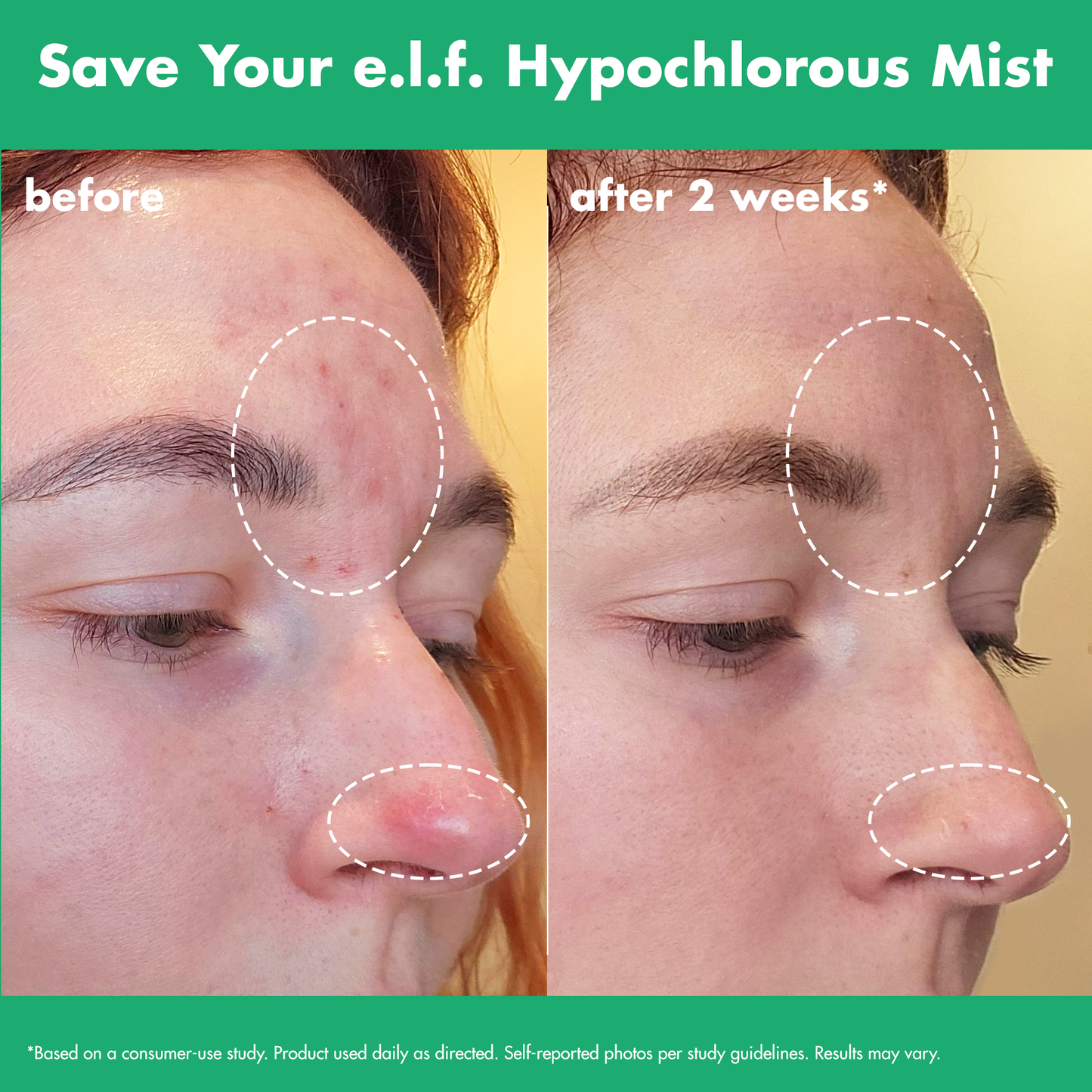 save-your-e-l-f-hypochlorous-mist-f0 FA26_EDUCATION_SAVEYOURELF_USAGE_BA1_WITHOUT_CLAIMS.png